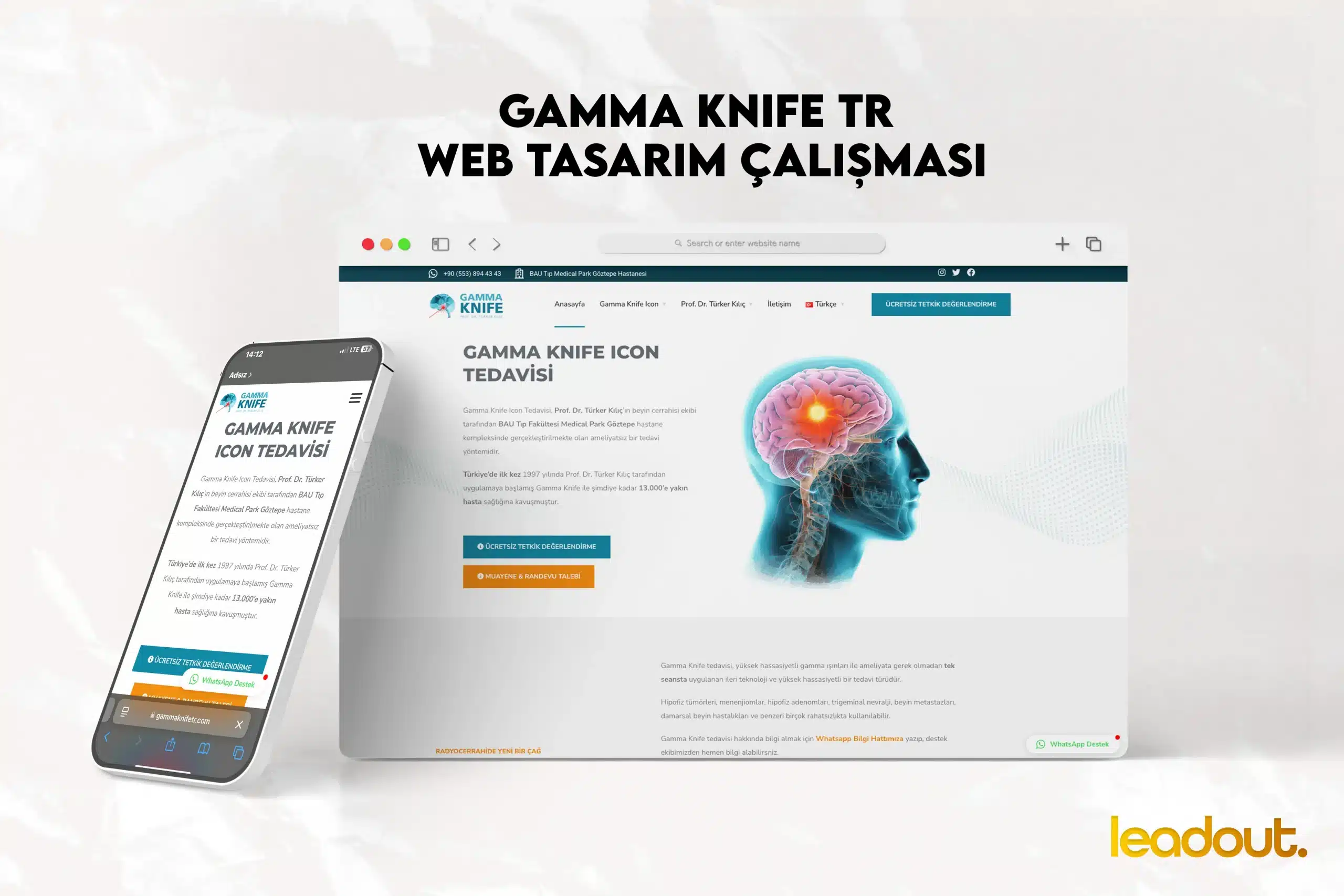 mersin-web-tasarim-gamma-knife